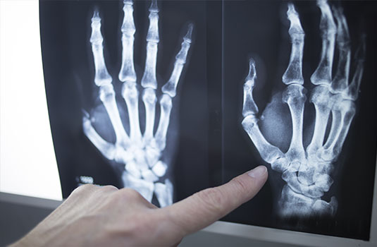 Action Rehab Hand Therapy - Moorabbin